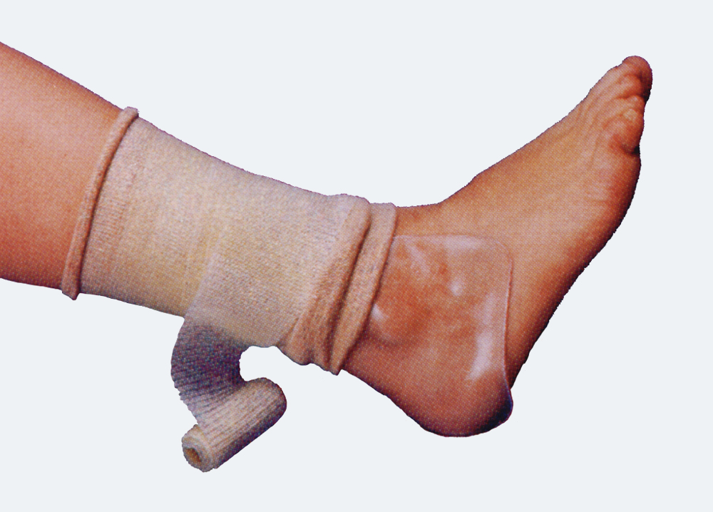 Padding For Splint at Mitchell Fredricksen blog